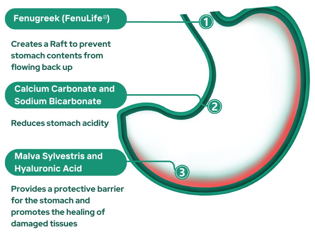 how-it-works-refluxg